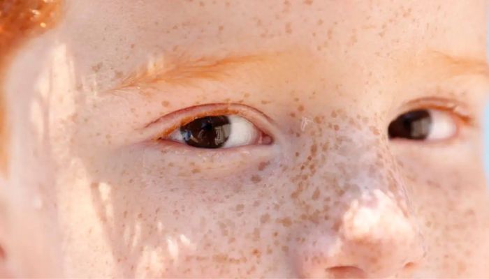 © Bruno Peres/Agência Brasil Reflexo branco nos olhos: entenda condição que assusta pais